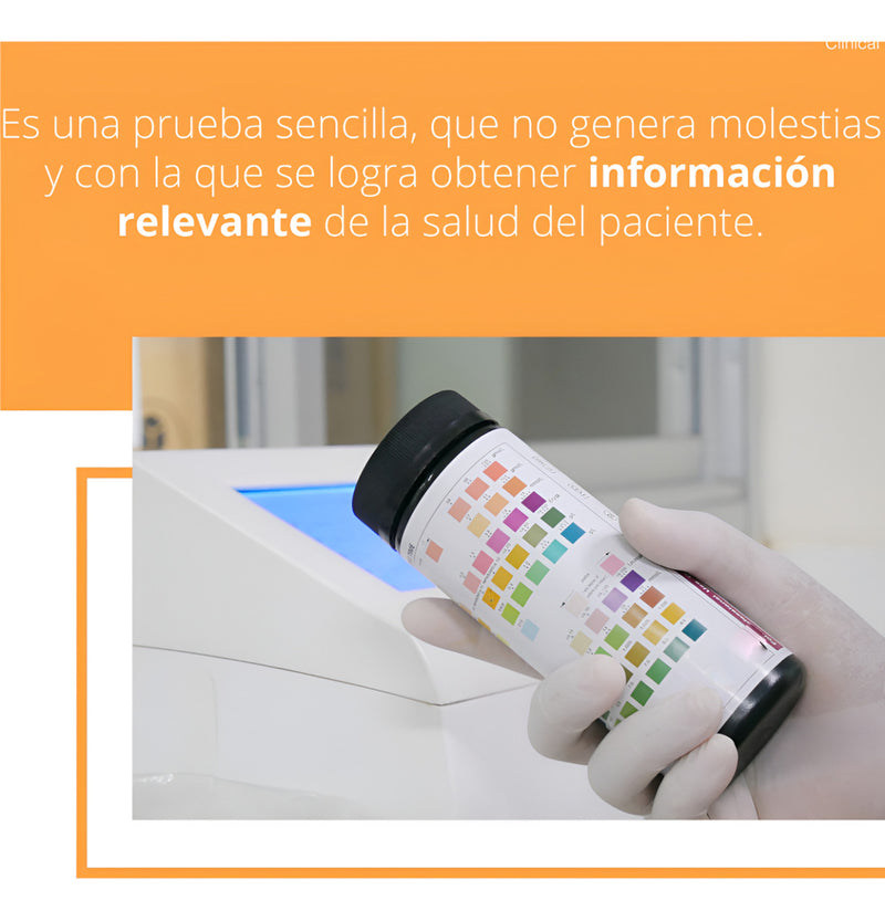 Cargue la imagen en el visor de la galería, Tiras de Uroanálisis Mission de 11 Parámetros - Kit con 100 pruebas